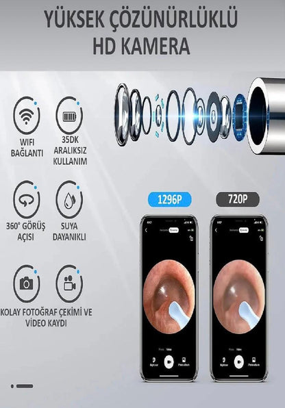 1080p KAMERALI KULAK TEMİZLEME CİHAZI (SET HALİNDEDİR)